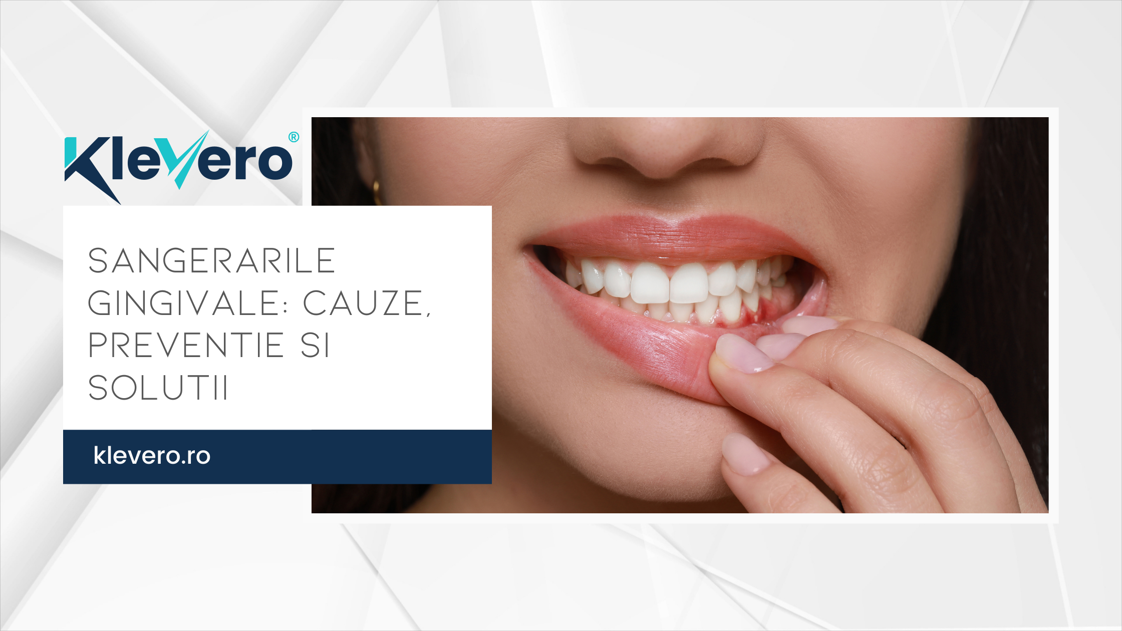 Sangerarile Gingivale: Cauze, Preventie si Solutii