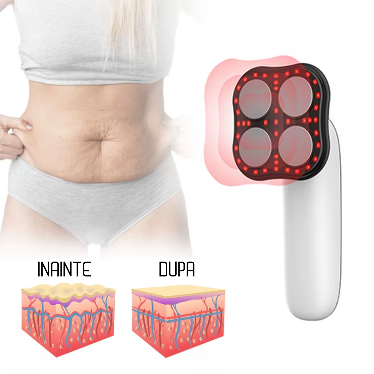 Aparat Anticelulitic Profesional 4 in 1 AnaStorya