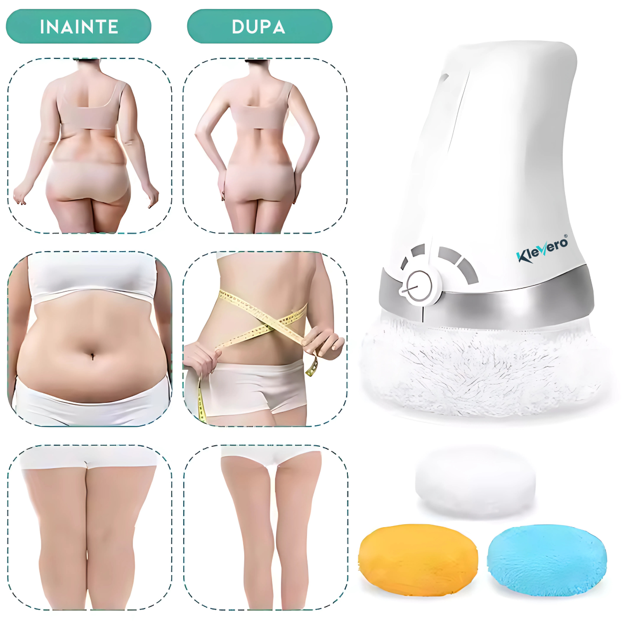 Aparat de masaj profesional anticelulitic AnaStorya