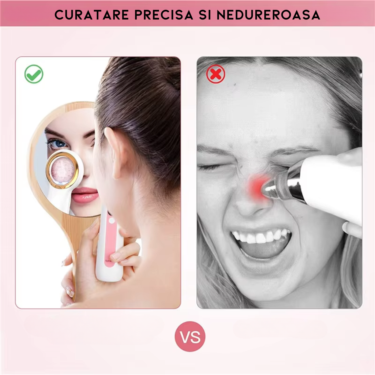 Aparat Profesional AnaStorya pentru Indepartarea Punctelor Negre cu Lupa si Lumina LED