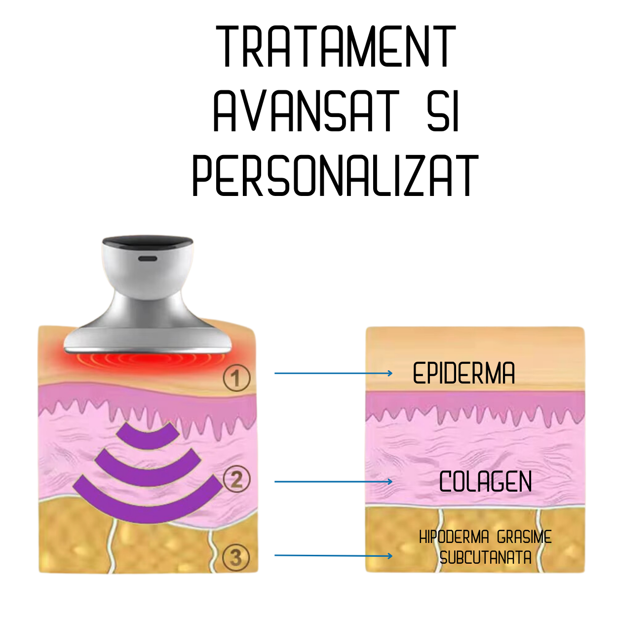 Aparat Anticelulitic pentru Modelare Corporala AnaStorya® Profesional