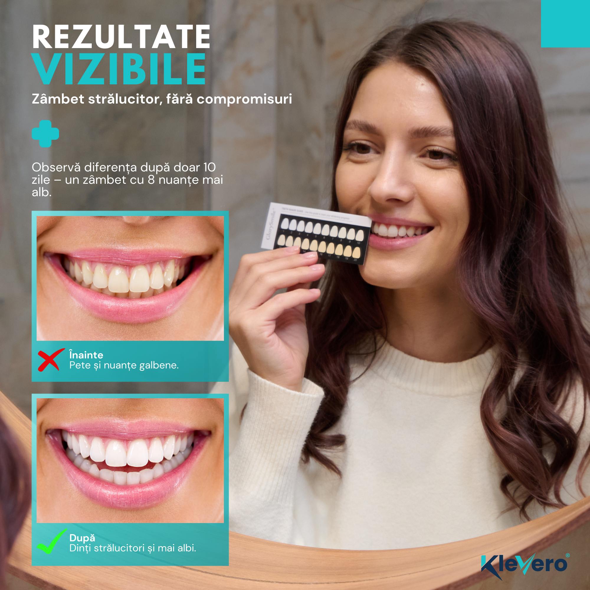 Kit Premium pentru Albirea Dintilor KleVero