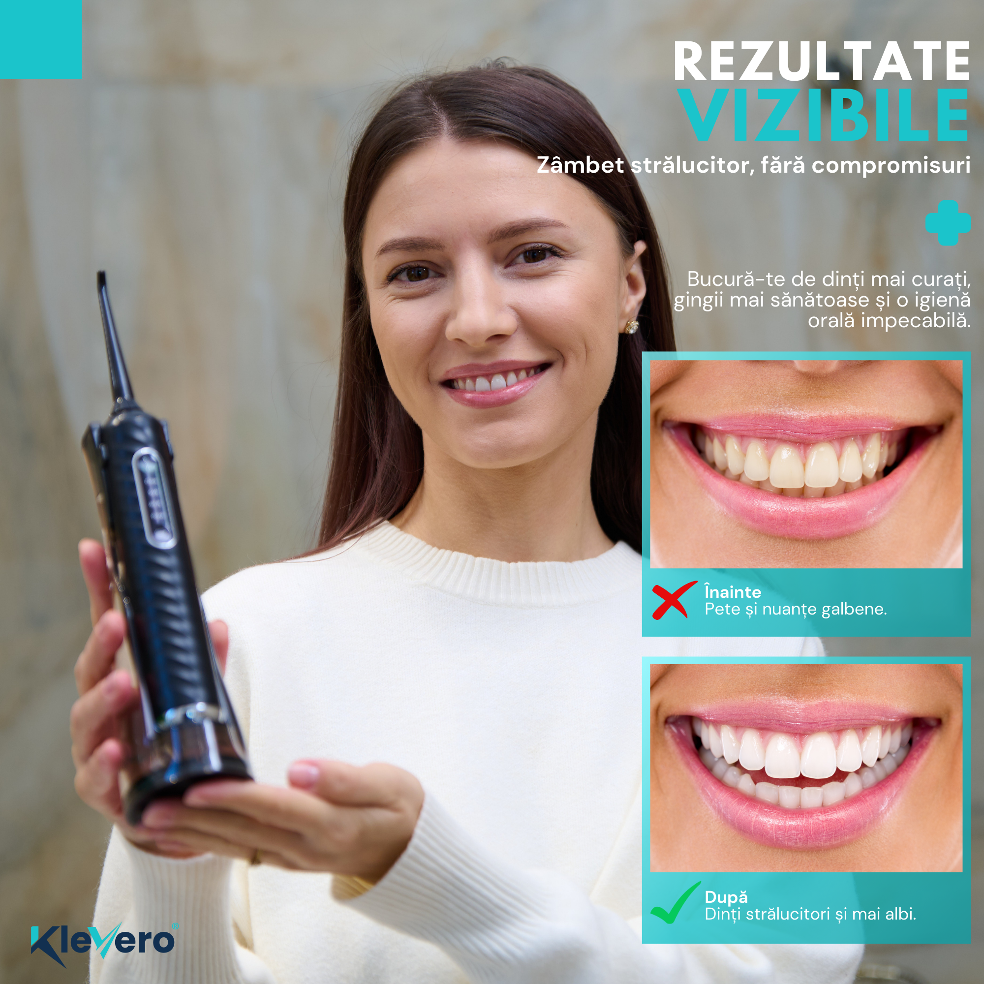 Irigator Bucal 3-in-1 cu Periuta Sonica Electrica si cap eliminare tartru KleVero