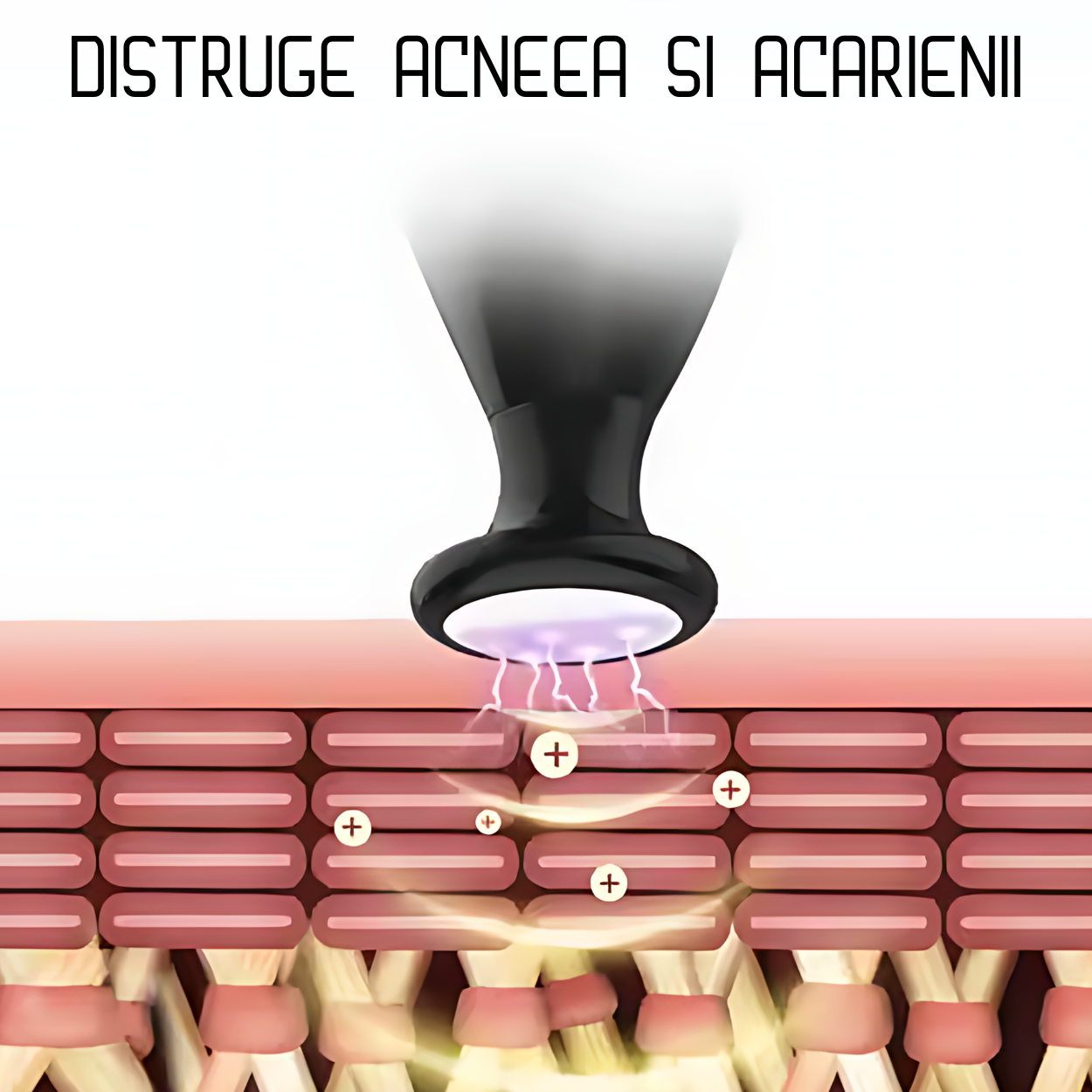 Aparat Portabil pentru Tratarea Acneei cu Plasma si Ozon Klevero® – Tehnologie Coreana