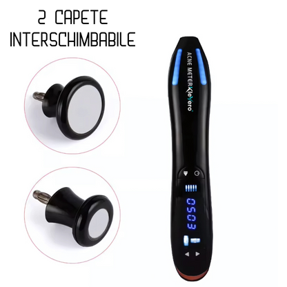 Aparat Portabil pentru Tratarea Acneei cu Plasma si Ozon Klevero® – Tehnologie Coreana