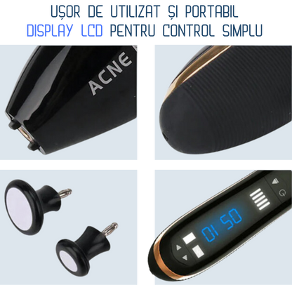 Aparat Portabil pentru Tratarea Acneei cu Plasma si Ozon Klevero® – Tehnologie Coreana