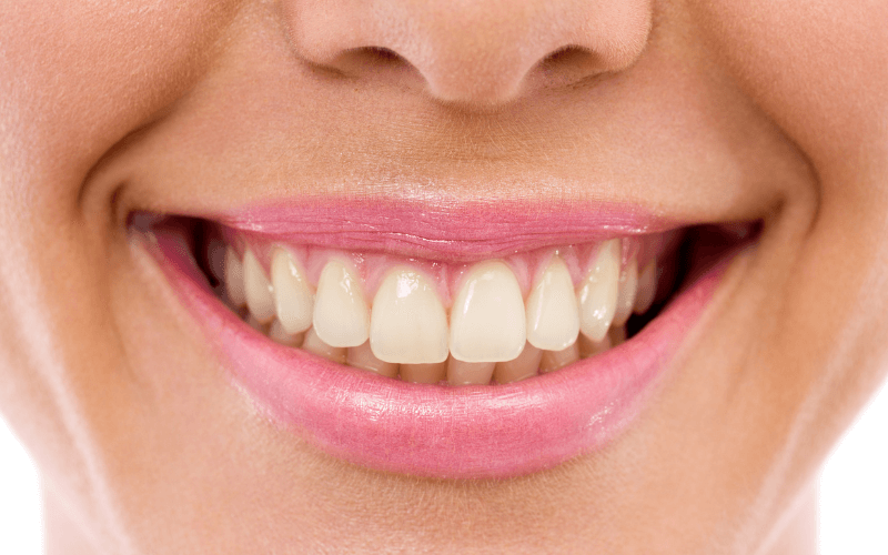 Rezultate vizibile înainte și după tratamentul dentar Klevero, evidențiind îmbunătățirea albirii și sănătății dinților.